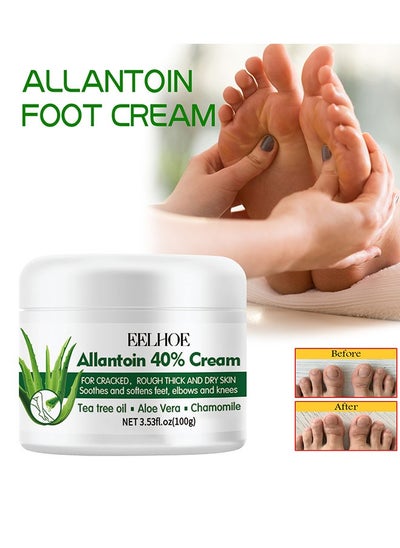 اشتري Foot Care Cream Allantoin 40% Cream For Cracked,Rough Thick and Dry Skin Soothes and Softens Feet,Elbows and Knees Hydrating and Moisturizing Foot Care Cream في الامارات