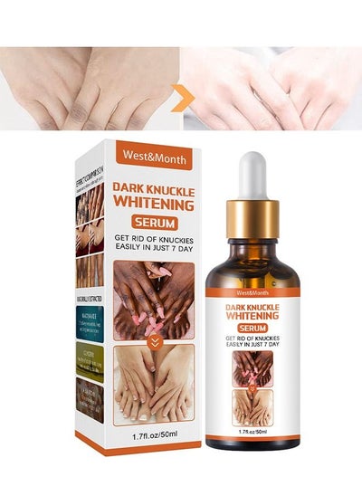 Buy Whitening Serum Hand Knuckle Glow Serum, Restoring Hand Treatment, Moisturizing, Exfoliates and Reduces Unbalanced Pigmentation, for Removing Dark Knuckle Elbow, Brighter, Firmer Skin in Saudi Arabia