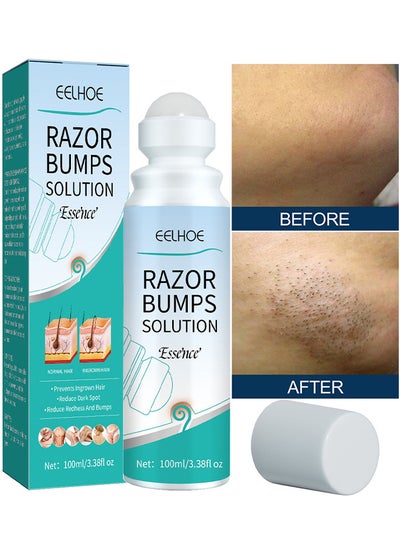 Buy Razor Bump Solution Essence, Prevents Ingrown Hair Reduce Dark Spot Reduce Redhess And Bumps, Hair Growth Inhibitor Safe And Gentle, Delay Hair Growth, No Black Spots, Roll-On 100ML in UAE