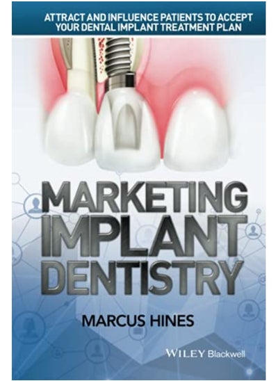 Buy Marketing Implant Dentistry Attract And Influence Patients To Accept Your Dental Implant Treatment in UAE