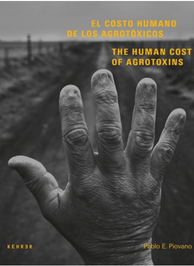 اشتري The Human Cost : Agrotoxins in Argentina في الامارات