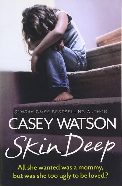 Buy Skin Deep printed_book_paperback english - 42299 in UAE