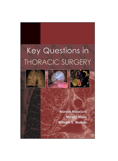 اشتري Key Questions in Thoracic Surgery Paperback 1st Edition في الامارات