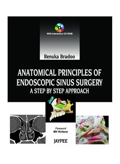 اشتري Anatomical Principles Of Endoscopic Sinus Surgery: A Step By Step Approach With Interactive CD-ROM في الامارات