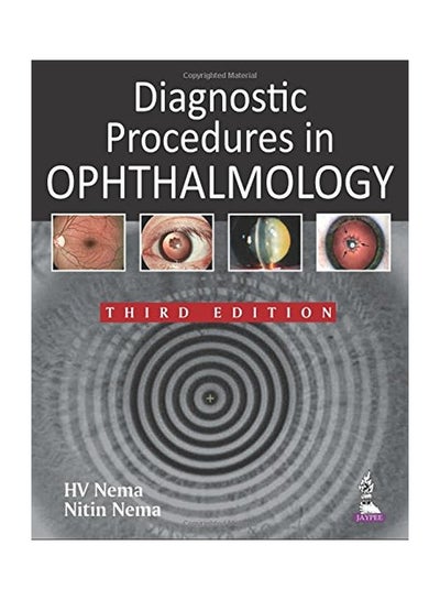 اشتري Diagnostic Procedures In Ophthalmology 3 Paperback في الامارات