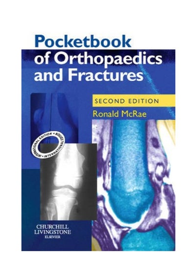 اشتري Pocketbook Of Orthopaedics And Fractures (Old Edition) paperback english - March في السعودية