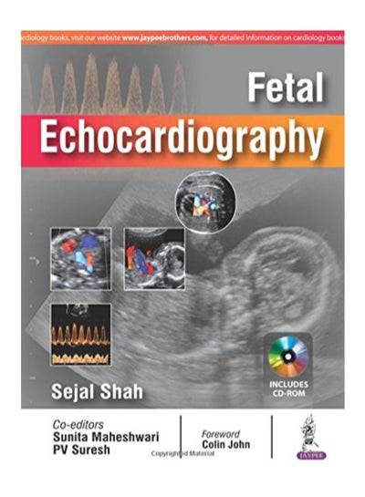 اشتري Fetal Echocardiography Paperback في الامارات