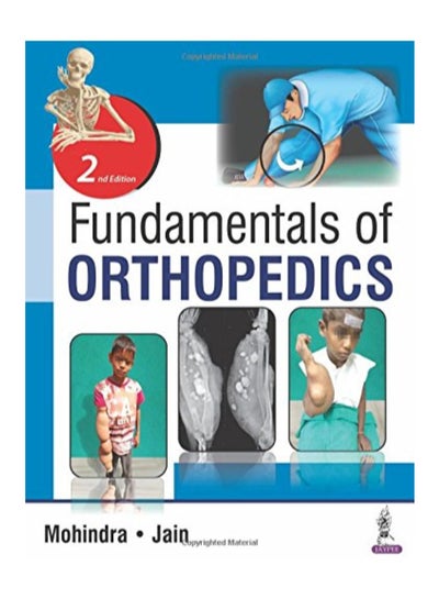 Buy Fundamentals Of Orthopedics paperback english in UAE