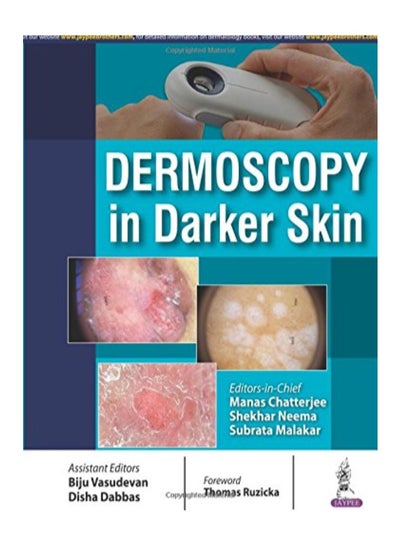 اشتري Dermoscopy In Darker Skin Paperback في الامارات