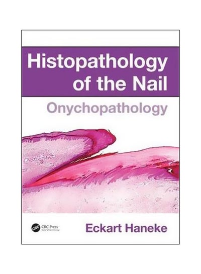 Buy Histopathology Of The Nail: Onychopathology hardcover english - 4 August 2017 in UAE