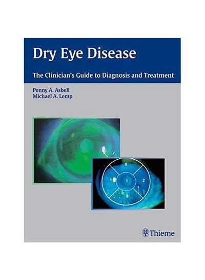 Buy Dry Eye Disease: The Clinician's Guide To Diagnosis And Treatment hardcover english - 01-Nov-06 in Egypt