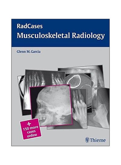 Buy Radcases Musculoskeletal Radiology Paperback English by Glenn M. Garcia - 24-Feb-10 in Egypt