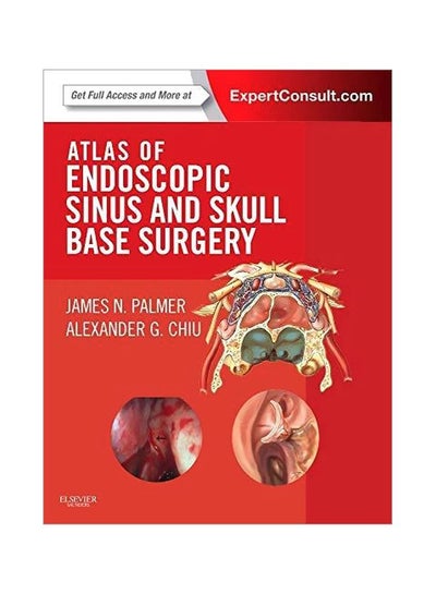 Atlas Of Endoscopic Sinus And Skull Base Surgery Hardcover Price In Egypt Noon Egypt Kanbkam 8012