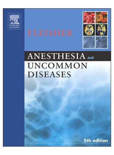 اشتري Anesthesia And Uncommon Diseases Hardcover 5th edition في مصر