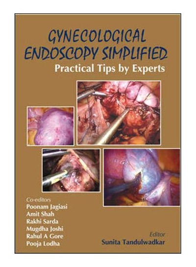 Buy Gynecological Endoscopy Simplified paperback english - 16-Sep-09 in Egypt