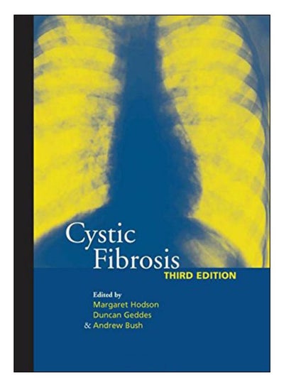 Buy Cystic Fibrosis Hardcover English by Margaret Hodson - 25-May-07 in Egypt