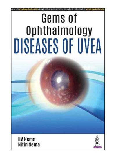 اشتري Gems Of Ophthalmology Diseases Of Uvea Paperback 1st edition في مصر