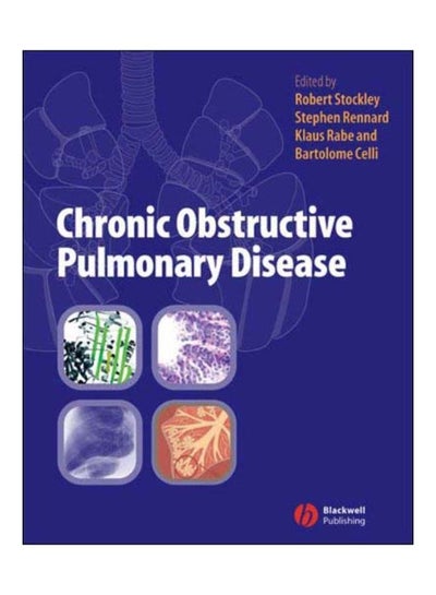 Buy Chronic Obstructive Pulmonary Disease hardcover english - 12-Dec-06 in Egypt