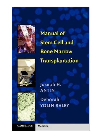 اشتري Manual Of Stem Cell And Bone Marrow Transplantation Paperback 1st edition في مصر