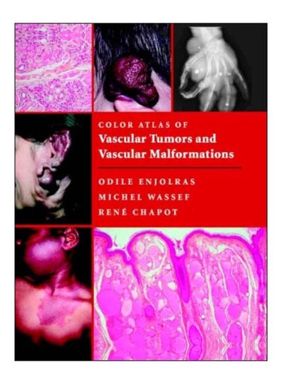 Buy Color Atlas Of Vascular Tumors And Vascular Malformations hardcover english - 2-Apr-07 in Egypt