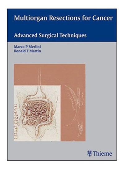 Buy Multiorgan Resections For Cancer Hardcover English by Marco Merlini - 24-May-06 in Egypt