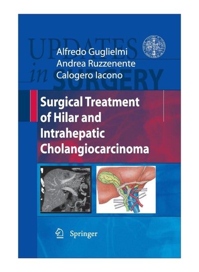 Buy Surgical Treatment Of Hilar And Intrahepatic Cholangiocarcinoma paperback english - 6-Feb-10 in Egypt