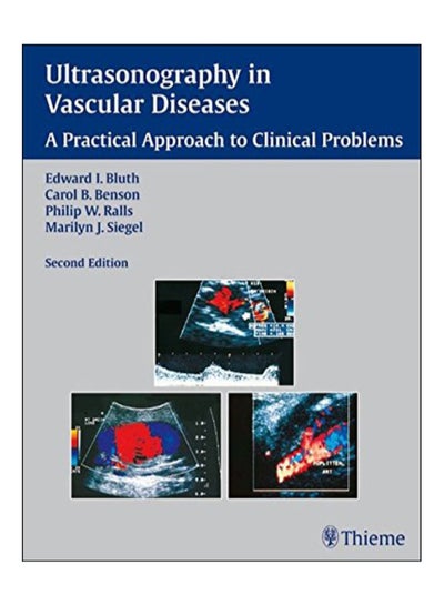 اشتري Ultrasonography In Vascular Diseases Paperback 2nd في مصر