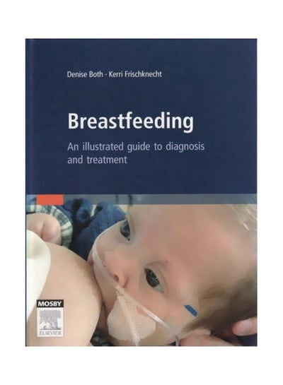 Buy Breastfeeding: An Illustrated Guide To Diagnosis And Treatment hardcover english - 14 Jul 2008 in Egypt