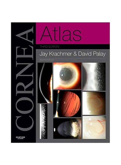 Buy Cornea Atlas: Expert Consult hardcover english - 10 Sep 2013 in Egypt