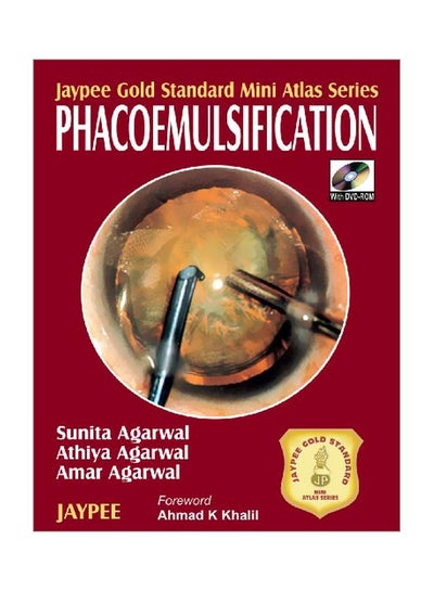 Buy Phacoemulsification With Dvd Rom paperback english - 30 May 2008 in Egypt