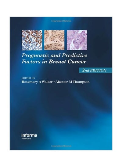 Buy Prognostic And Predictive Factors In Breast Cancer paperback english - 01 Oct 2008 in Egypt