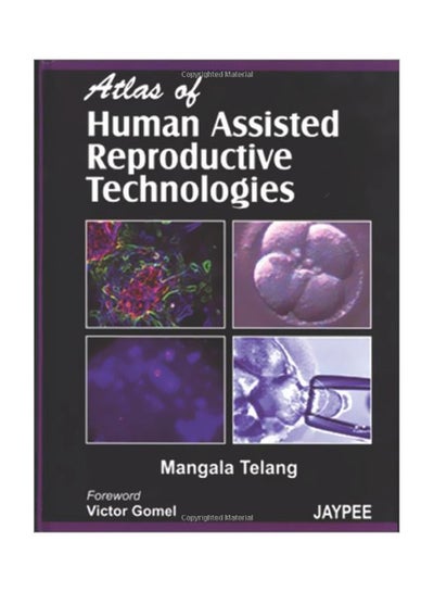 Buy Atlas Of Human Assisted Reproductive Technoloies Paperback English by Margala Telang - 30 May 2007 in Egypt