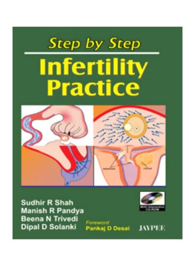 اشتري Step By Step Infertility Practice 2007 paperback english - 30 May 2007 في مصر