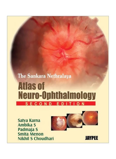 Buy The Sankara Nethralaya Atlas Of Neuro-ophthalmology paperback english - 30 May 2008 in Egypt