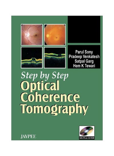 اشتري Step By Step Optical Coherence Tomography With Photo Cd-rom كتاب صوتي في مصر