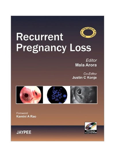 اشتري Recurrent Pregnancy Loss 2 في مصر