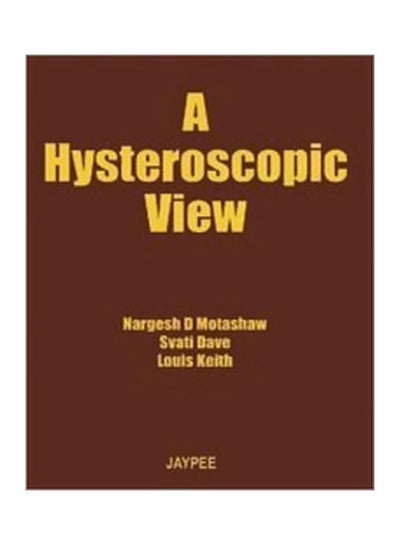 Buy A Hysteroscopy View hardcover english - 30 May 2008 in Egypt