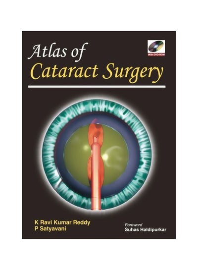 اشتري Atlas Of Cataract Surgery hardcover english - 24 Jul 2009 في مصر