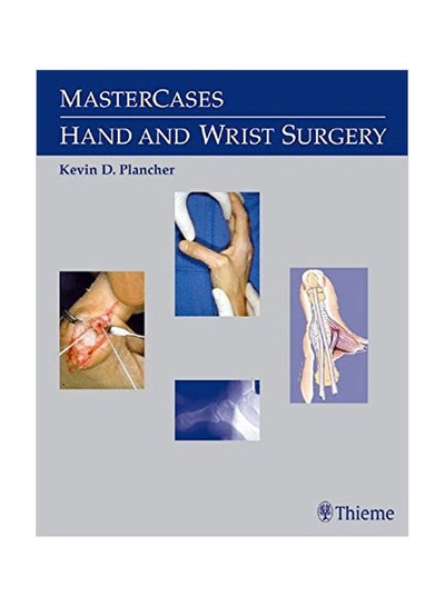 اشتري Mastercases In Hand And Wrist Surgery Paperback في مصر