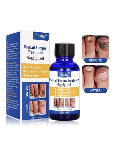 Buy Toenail Fungus Treatment Multicolour 30ml in UAE